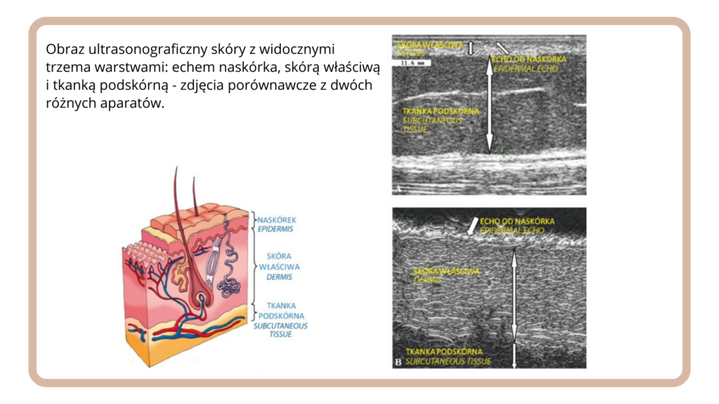 Obraz ultrasonograficzny skóry, aparatura i podstawy obrazowania